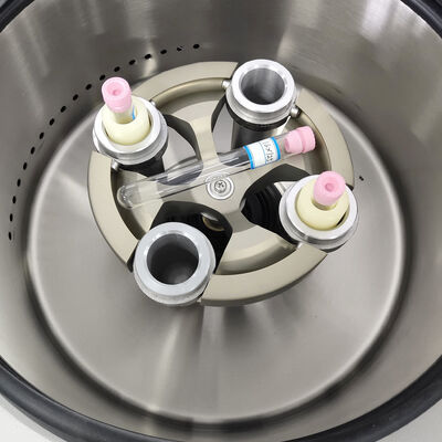 Centrifuga PRP con velocità massima di 5000 giri/min e RCF di 3555xg e display LCD per uso di laboratorio